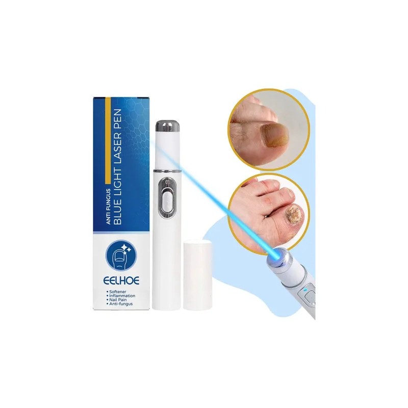 Pluma Luz Azul Elimina Hongo Cuidado Uñas Reparacion Láser F