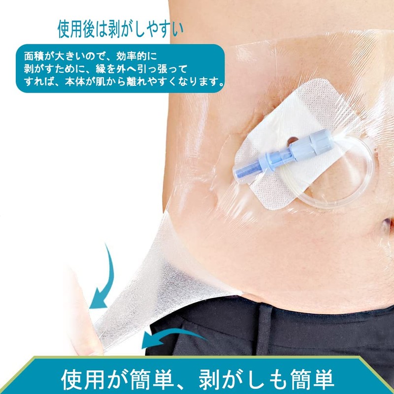 腹膜透析防水フィルム,装具とキズ口に防水,PDカテーテルに防水カバー, 入浴用 袋排水,袋排水腹部固定 介助,男女兼用 (腹部防水フィルム30枚, 15x18cm)