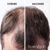 Brains & Son Streuhaar - Premium Haarverdichtung / Schütthaar mit