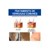 Sistema Verruga Elimina Plantar Comunes 30ml Neutra