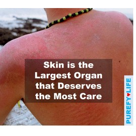 PUREFY Topical Airesol Spray (3.4oz), Soothing Face & Body Skin Spray, Purefypro Dermal HOCL Technology, Natural Skincare Support Redness, Irritations, Eyelid Eyelash Bumps, Dry Skin, Athletic Itch