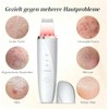 Peeling ultrasónico facial LOTOVERDE 4‑modos – Limpieza profunda y lifting