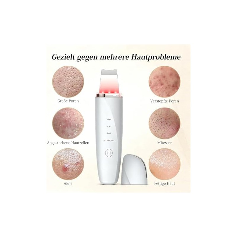 Peeling ultrasónico facial LOTOVERDE 4‑modos – Limpieza profunda y lifting