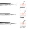 Professional Facial Blackhead Remover Tweezers,3Pcs Precision Pimple Popper Tool Kit