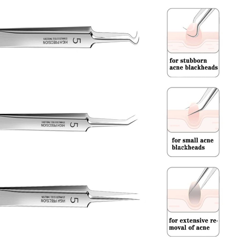 Professional Facial Blackhead Remover Tweezers,3Pcs Precision Pimple Popper Tool Kit
