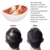 Hair Growth Helmet Red Blue Lighting 62pcs Light Chips Awaken