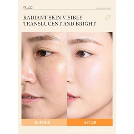 Facial con Vitamina C, Retinol 0.2%, Niacinamida 5%, Ácido Hialurónico 5%, 30 ml