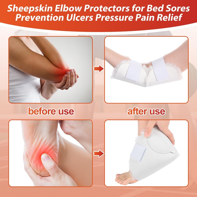 4 Pcs Elbow and Heel Protector Medium Sheepskin Heel Arm