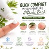 Hydrocortisone Cream 1% w/w Bite and Sting Cream, Mosquito and