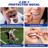 4 PCS Guarda Dental para Dormir, Protector Bucal de Dientes