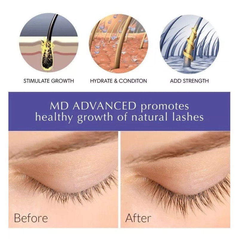 BL Lashes Suero De Crecimiento De Pestañas Avanzado Md Advanced