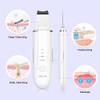 ANLAN Peeling Ultrasnico Facial Skin Scrubber Exfoliacin Facial Ultrasnica Limpiador