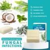 PURESKIN Sulfur & Tea-Tree-Oil Soap Bar: Natural Deep Cleansing for