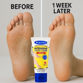 Aavini Foot Cream 50g – Quick Crack Fix, Soft Feet | 30% Off Limited