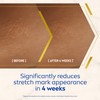NIVEA Luminous 630 Anti Stretch Marks & Dark Spots Body