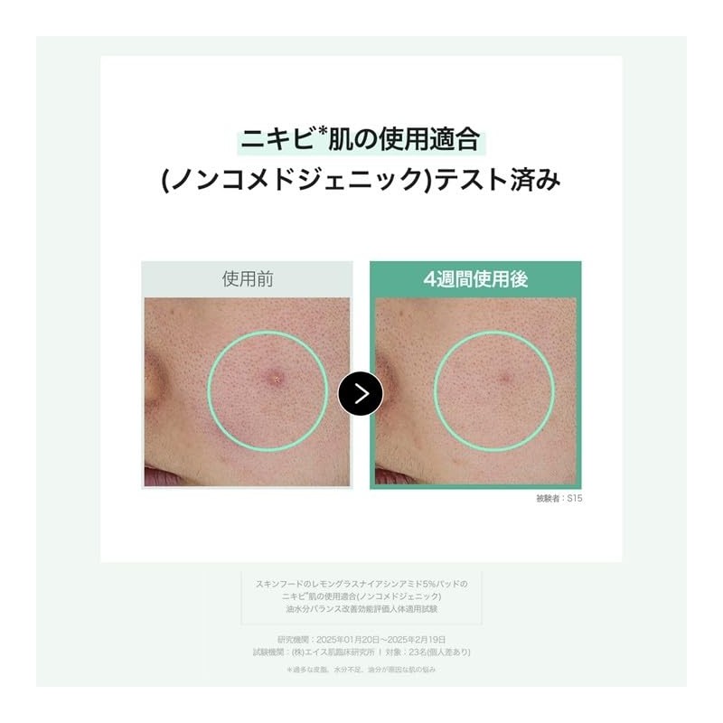 SKINFOOD Lemon Grass Niacinamide 5 Pads (8.8 oz (250 g)