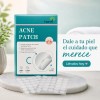 Parches Antiacné Absorben Grasa Espinillas Granitos 72 Pz