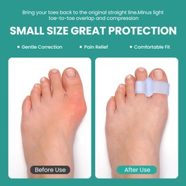 Welnove Pack of 12 Bunion Corrector, Toe Separators with 2 Loops, Big Toe Spacer Suitable for Bunion and Overlap Toe (Purple)