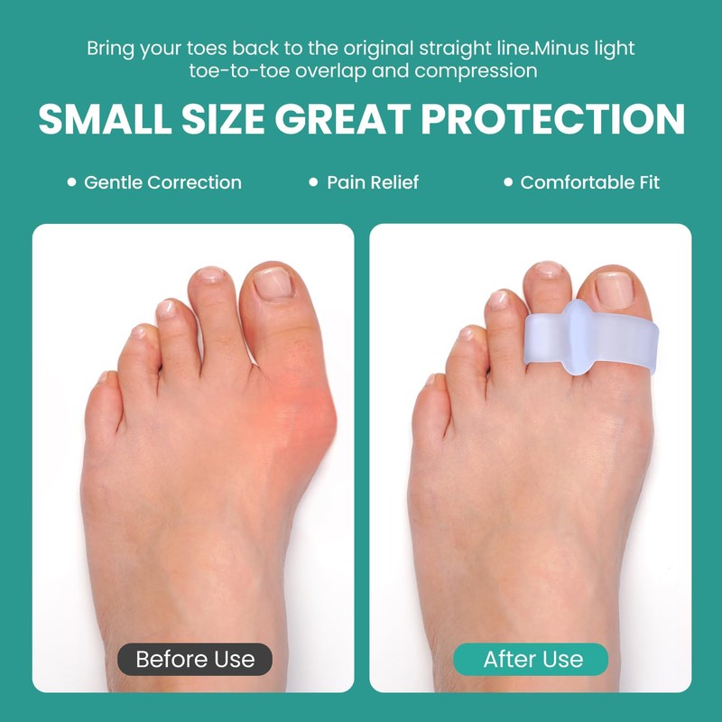 Welnove Pack of 12 Bunion Corrector, Toe Separators with 2