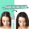 Sérum Para El Crecimiento Del Cabello Herstyler Biotina Con