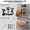 Dent Puller Kit - Paintless Dent Removal Kit with Slide