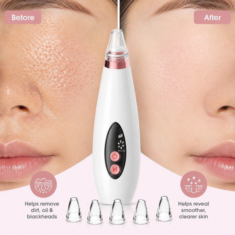 USB Rechargeable Blackhead Remover – Adjustable Suction Pore Vacuum Cleaner