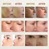 Crema Facial Despigmentante Y Aclarante 20g Todo Tipo De Piel