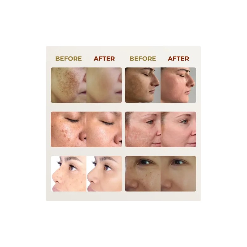 Crema Facial Despigmentante Y Aclarante 20g Todo Tipo De Piel