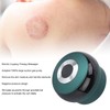 Electric Cupping Massager Negative Pressure Large Suction Heating Gua Sha