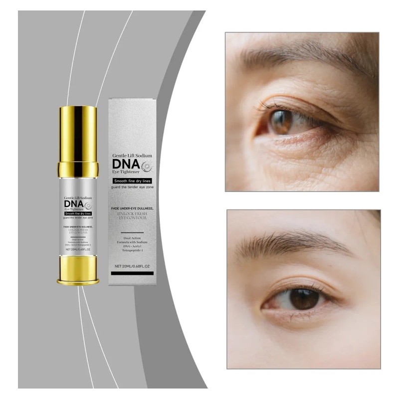 El Tensor De Ojos Gentle Lift Sodium Dna Suaviza Las