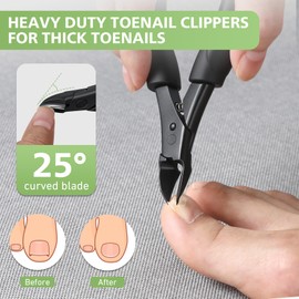 BALUCA Heavy Duty Toenail Clippers for Thick Nails & Seniors – Straight & Curved Blade Professional Nail Clipper Set with 360° Rotating Head, Nail Lifter – Ingrown Toenail Tool Solution