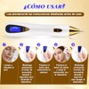 Plasma Pen Dispositivo de Belleza Para La Eliminación de Imperfecciones