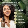 Batana Oil Hair Growth Serum with Rosemary, Scalp Detox Treatment,