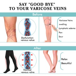 Compression Pantyhose Women 20-30 mmHg Stockings for Varicose Veins (Black, XXL)