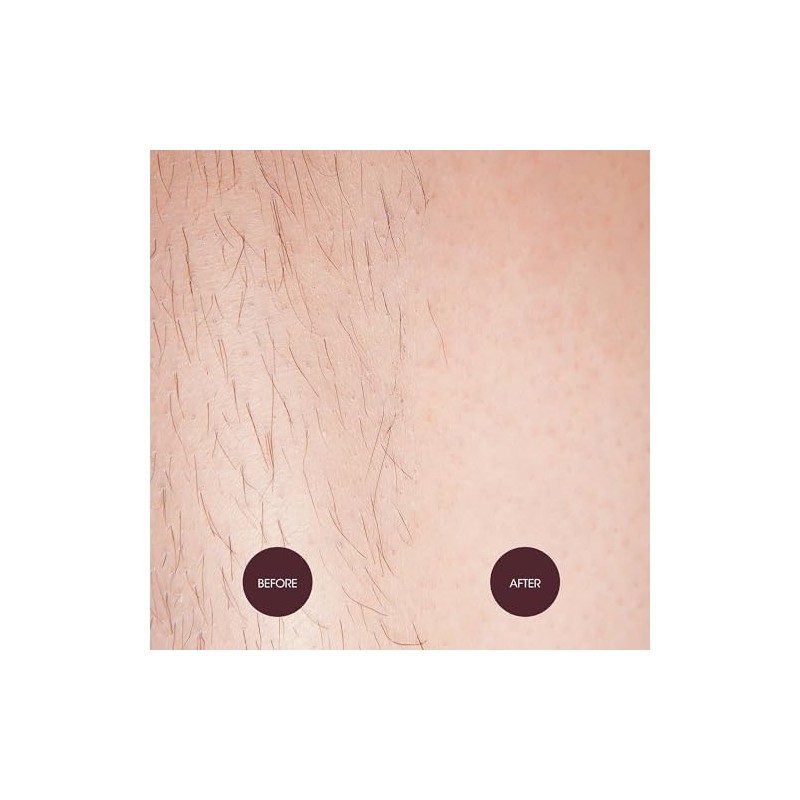NAD'S 4903EN06 Sensitive Hair Removal Cream, 5.1 Ounce