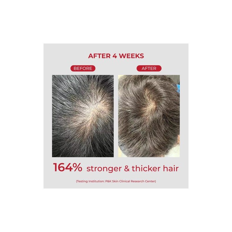 moev [moev]Annurcatin Shampoo 300ml