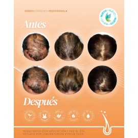 Vial Boost Capilar Biotina Dermapen Células Madre Head Spa