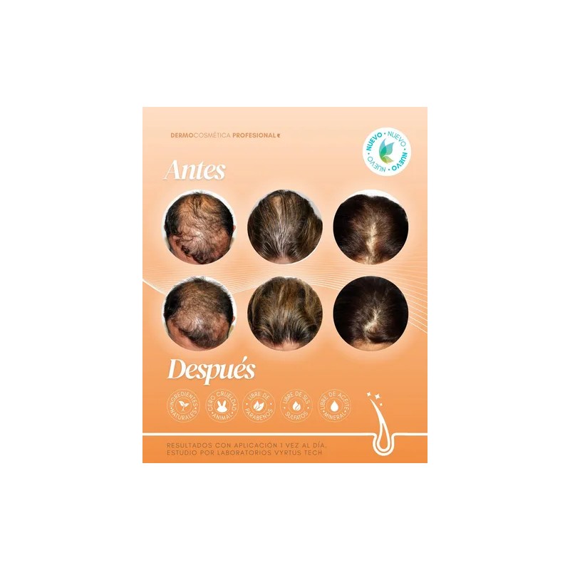 Vial Boost Capilar Biotina Dermapen Células Madre Head Spa