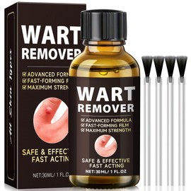 Wart Remover,Skin Tag Removal Kit Fast-Acting Skin Tag & Wart Remover for Feet & Hands,Wart Removal for Plantar Wart and Common Wart,Safe & Natural (30ML)