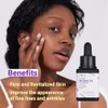 Suero ISNTREE Hyper Retinol EX 1.0 20 ml | Regalos