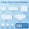 Large Pimple Patches for Face, Hydrocolloid Acne Patches, Variety Shapes