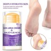 lolxlol 60% Urea Cream - 1.41 oz Lavender Foot Hand