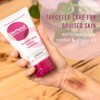 Dermend Moisturizing Bruise Formula Cream, 4.5 Oz by Ferndale by