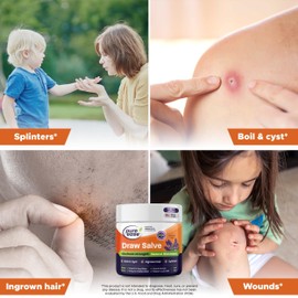 Pure Ease Pure Ease Drawing Salve Ointment 2oz