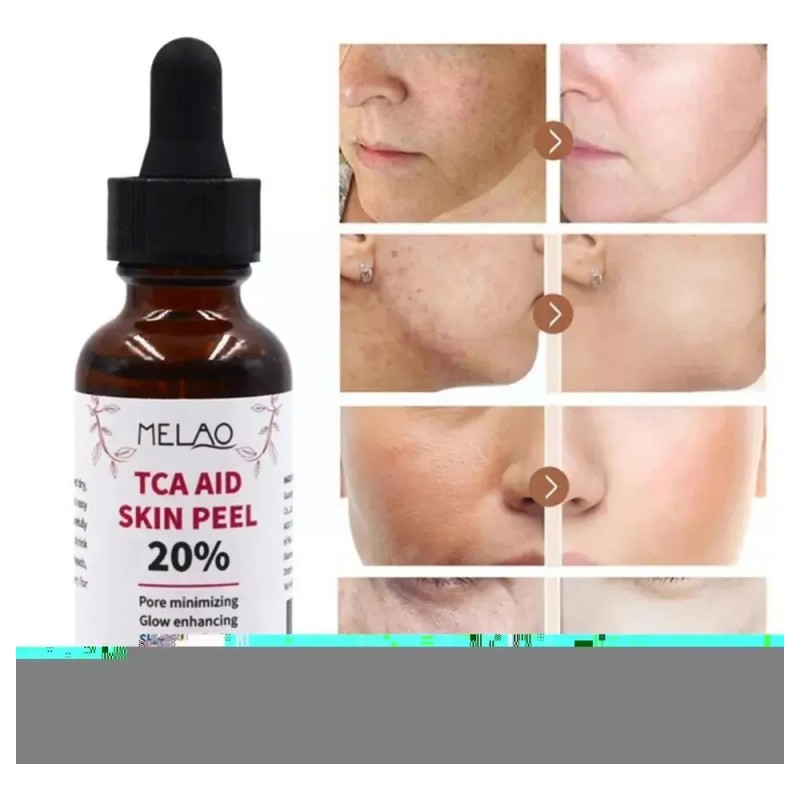 . 30 Ml De Tca Aid Exfoliante Para La Piel,