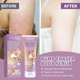 Repair Chicken Skin Body Scrub Keratosis Pilaris Lotion ffor Strawberry Legs  Dark Spot Removal KP Bump Smooth Lotion Skin Care