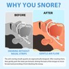Anti Snoring Snoring Stopper - Professional Anti-Snoring, Adjustable Bite Splint