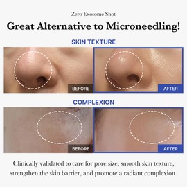 medicube medicube Zero Exosome Shot 7,500 PPM Spicule Facial Serum | Liquid Skin Booster Serum | Exosome, AHA+BHA+PHA | Pore Care, Dead Skin Cells, Skin Texture | Korean Skin Care 1.01 fl.oz