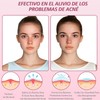 96 Estrellas para Granos, 3 Cajas de Parches para Acne