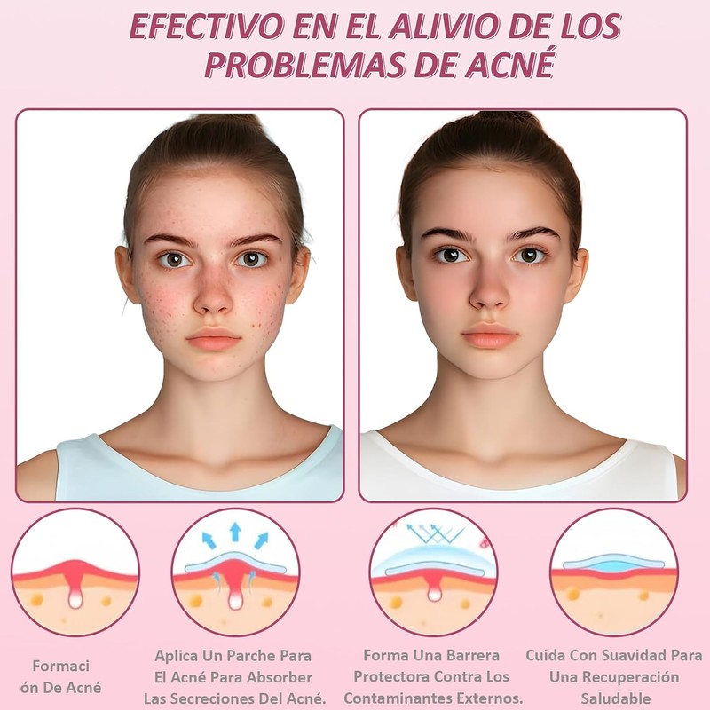 96 Estrellas para Granos, 3 Cajas de Parches para Acne